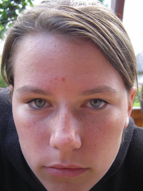 2007-06-28-rad-373 
